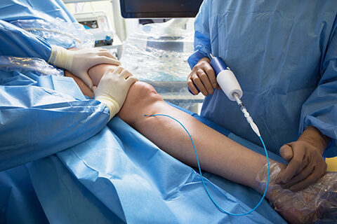 Cirurgia Vascular